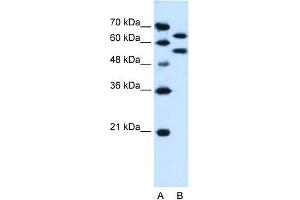 WB Suggested Anti-SIL1 Antibody Titration:  0. (SIL1 Antikörper  (N-Term))