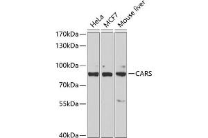Western blot analysis of extracts of various cell lines, using CARS antibody (ABIN6129260, ABIN6137946, ABIN6137948 and ABIN6222203) at 1:1000 dilution. (CARS Antikörper  (AA 469-748))