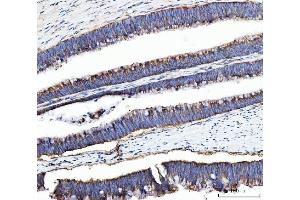 IHC analysis of UBA5 using anti-UBA5 antibody (ABIN7601503). (UBA5 Antikörper  (AA 37-389))