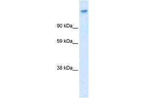 WB Suggested Anti-CACNA2D1 Antibody Titration:  0. (CACNA2D1 Antikörper  (Middle Region))