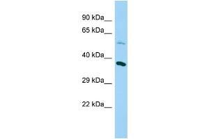 Host: Rabbit Target Name: NDUFAF5 Sample Type: Fetal Heart lysates Antibody Dilution: 1. (C20orf7 Antikörper  (N-Term))