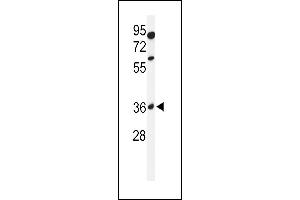 GLT8D2 anticorps  (N-Term)