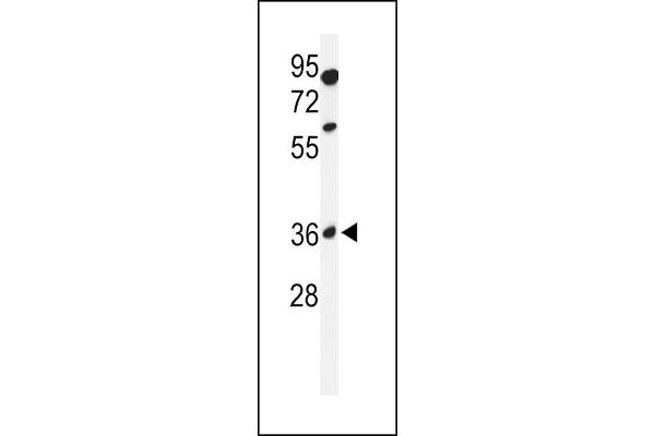 GLT8D2 anticorps  (N-Term)