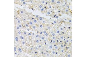 Immunohistochemistry of paraffin-embedded mouse liver using IGF1R antibody (ABIN5970073) at dilution of 1/100 (40x lens). (IGF1R Antikörper  (N-Term))