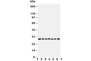 Western blot testing of Kallikrein-11 antibody and Lane 1:  U87;  2: A549; 3: HeLa;  4: MM231;  5: MM453;  6: COLO320;  7: Jurkat cell lysate. (Kallikrein 11 Antikörper  (C-Term))