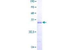 CABP4 Protein (AA 1-170) (GST tag)