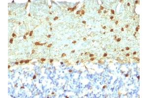 Immunohistochemistry (IHC) image for anti-Fascin (FSCN1) antibody (ABIN6940609)