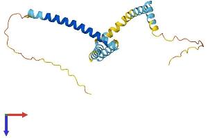 TPD52L2 Protein (AA 1-206) (His tag)
