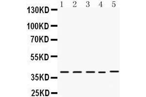 Western Blotting (WB) image for anti-Doublesex and Mab-3 Related Transcription Factor 1 (DMRT1) (AA 98-128), (N-Term) antibody (ABIN3043450) (DMRT1 Antikörper  (N-Term))