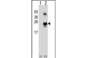 Western blot analysis of GADD45A (arrow) using rabbit polyclonal GADD45A Antibody (C-term) (ABIN650724 and ABIN2839408).