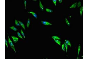 Immunofluorescence (IF) image for anti-Mannosidase Processing 1 (MAP1) (AA 401-600) antibody (ABIN7159746)