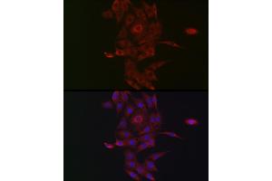 Immunofluorescence analysis of PC-12 cells using NRP2 Rabbit pAb (ABIN3016282, ABIN3016283, ABIN3016284, ABIN1681113 and ABIN6219689) at dilution of 1:50 (40x lens). (NRP2 Antikörper  (AA 150-420))