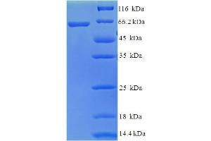 SDS-PAGE (SDS) image for HUTI (AA 1-426), (full length) protein (His-SUMO Tag) (ABIN5711672) (HUTI (AA 1-426), (full length) protein (His-SUMO Tag))