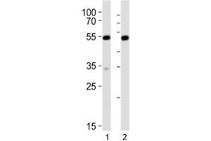 Western blot analysis of lysate from 1) mouse NIH3T3 and 2) rat C6 cell line using Srf antibody at 1:1000. (SRF Antikörper  (C-Term))