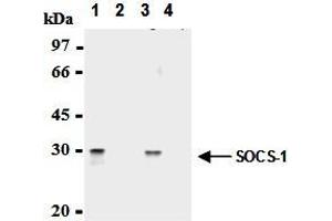 Immunoprecipitation of SOCS-1 from mouse splenocytes and mouse thymocytes with AM26561AF-N (1,3) or mouse IgG1 (2,4). (SOCS1 Antikörper  (AA 2-78))
