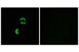 Immunofluorescence analysis of A549 cells, using LDLRAD3 antibody. (LDLRAD3 Antikörper)