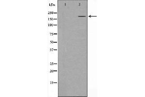 Western blot analysis of extracts of A431 , using TET1 antibody.