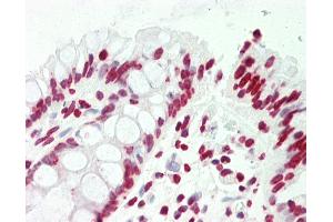 Anti-CCNL2 / Cyclin L2 antibody IHC staining of human colon.