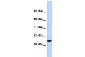 Image no. 1 for anti-Tumor Protein D52-Like 3 (TPD52L3) (AA 71-120) antibody (ABIN6744307) (TPD52L3 Antikörper  (AA 71-120))