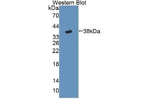 Figure. (CYP17A1 Antikörper  (AA 201-507))