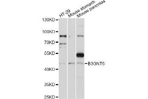 Western blot analysis of extracts of various cell lines, using B3GNT6 antibody (ABIN6292802) at 1:1000 dilution.