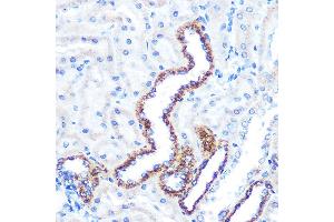 Immunohistochemistry of paraffin-embedded rat kidney using  Rabbit mAb (ABIN7265589) at dilution of 1:100 (40x lens). (Angiopoietin 2 Antikörper)