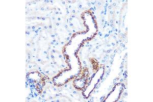 Immunohistochemistry of paraffin-embedded rat kidney using  Rabbit mAb (ABIN7265589) at dilution of 1:100 (40x lens).