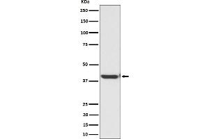 Western blot analysis of ENDOGL1 / ENGL expression in HepG2 cell lysate. (Rekombinanter EXOG Antikörper)