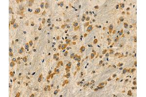 ABIN6258427 and ABIN6275063 at 1/100 staining Mouse brain tissue by IHC-P. (DMGDH Antikörper  (C-Term))