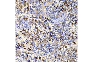 Immunohistochemistry of paraffin-embedded rat spleen using UBASH3B antibody (ABIN5974296) at dilution of 1/100 (40x lens). (UBASH3B Antikörper)