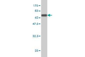 Western Blot detection against Immunogen (64. (THUMPD1 Antikörper  (AA 1-353))