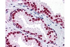 Anti-SAFB antibody IHC of human prostate.