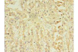 Immunohistochemistry of paraffin-embedded human adrenal gland tissue using ABIN7167480 at dilution of 1:100 (RIPK3 Antikörper  (AA 1-518))