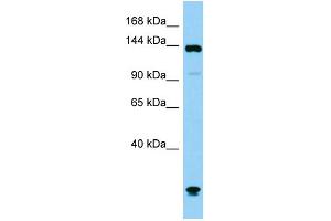 Host: Rabbit Target Name: Plcb1 Sample Type: Mouse Testis lysates Antibody Dilution: 1. (Phospholipase C beta 1 Antikörper  (C-Term))