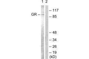 Western blot analysis of extracts from Jurkat cells, treated with EGF (200 ng/mL, 15 mins), using GR (Ab-226) antibody. (Glucocorticoid Receptor Antikörper  (Ser226, Ser234, Ser246))