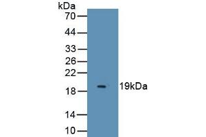 Detection of Recombinant ESM1, Human using Monoclonal Antibody to Endothelial Cell Specific Molecule 1 (ESM1) (ESM1 Antikörper  (AA 20-184))
