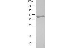 Western Blotting (WB) image for Peroxiredoxin 4 (PRDX4) (AA 38-123) protein (His-IF2DI Tag) (ABIN7124364) (Peroxiredoxin 4 Protein (PRDX4) (AA 38-123) (His-IF2DI Tag))