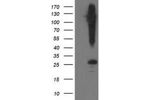 Western Blotting (WB) image for anti-Synaptosomal-Associated Protein, 25kDa (SNAP25) antibody (ABIN1501016) (SNAP25 Antikörper)