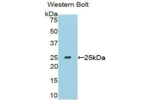 Detection of Recombinant SOSTDC1, Mouse using Polyclonal Antibody to Sclerostin Domain Containing Protein 1 (SOSTDC1) (SOSTDC1 Antikörper  (AA 24-206))