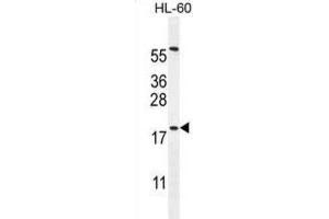 Western Blotting (WB) image for anti-Developmental Pluripotency Associated 5 (DPPA5) antibody (ABIN2996143) (DPPA5 Antikörper)
