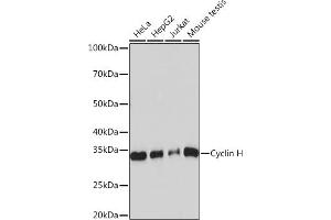 Western blot analysis of extracts of various cell lines, using Cyclin H Rabbit mAb (ABIN7266569) at 1:1000 dilution. (Cyclin H Antikörper)
