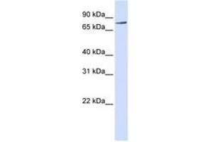 Image no. 1 for anti-Receptor-Interacting Serine-threonine Kinase 4 (RIPK4) (C-Term) antibody (ABIN6740940) (RIPK4 Antikörper  (C-Term))
