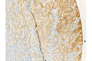 ABIN7094514 and ABIN7098563 at 1/100 staining Rat kidney tissue by IHC-P. (PDE4A Antikörper  (C-Term))