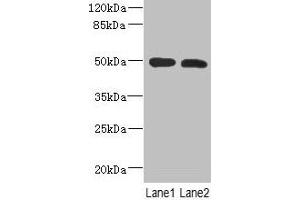 Western Blot All lanes: RGMA antibody at 12 μg/mL Lane 1: Mouse brain tissue Lane 2: Hela whole cell lysate Secondary Goat polyclonal to rabbit IgG at 1/10000 dilution Predicted band size: 50, 48, 51 kDa Observed band size: 50 kDa (RGMA Antikörper  (AA 153-408))