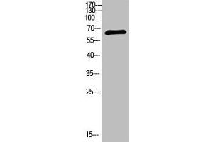 Western Blot analysis of 293T cells using primary antibody diluted at 1:1000(4 °C overnight). (NUT (AA 1082-1131) Antikörper)