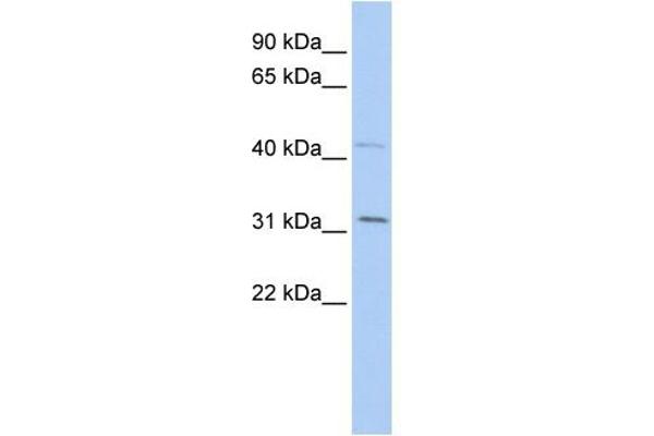 SIX Homeobox 1 Antikörper  (Middle Region)