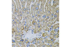 Immunohistochemistry of paraffin-embedded human liver injury using EPO antibody (ABIN5973306) (40x lens). (EPO Antikörper)