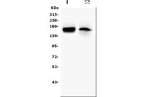 Western blot analysis of TEK using anti-TEK antibody (ABIN7600762). (TEK Antikörper  (AA 23-616))
