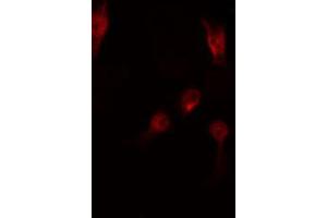 ABIN6267513 staining RAW264. (STAT5 A/B Antikörper  (pSer725, pSer730))