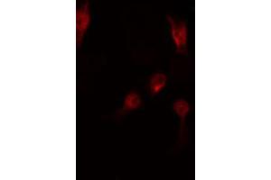 ABIN6267513 staining RAW264. (STAT5 A/B Antikörper  (pSer725, pSer730))
